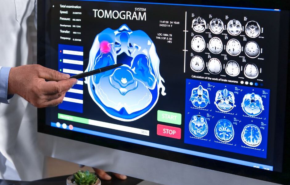 Predictive Analytics and AI in Healthcare: Using AI to Predict Patient Outcomes